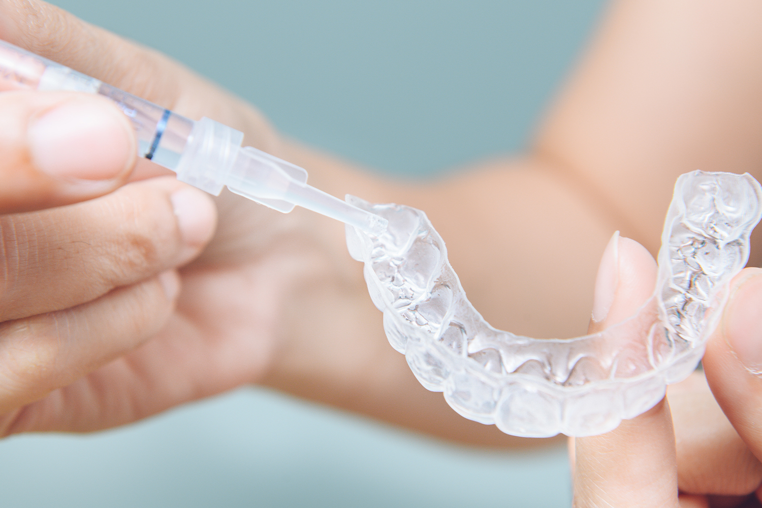 ホームホワイトニング